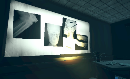 Sommeil à l'aiguille